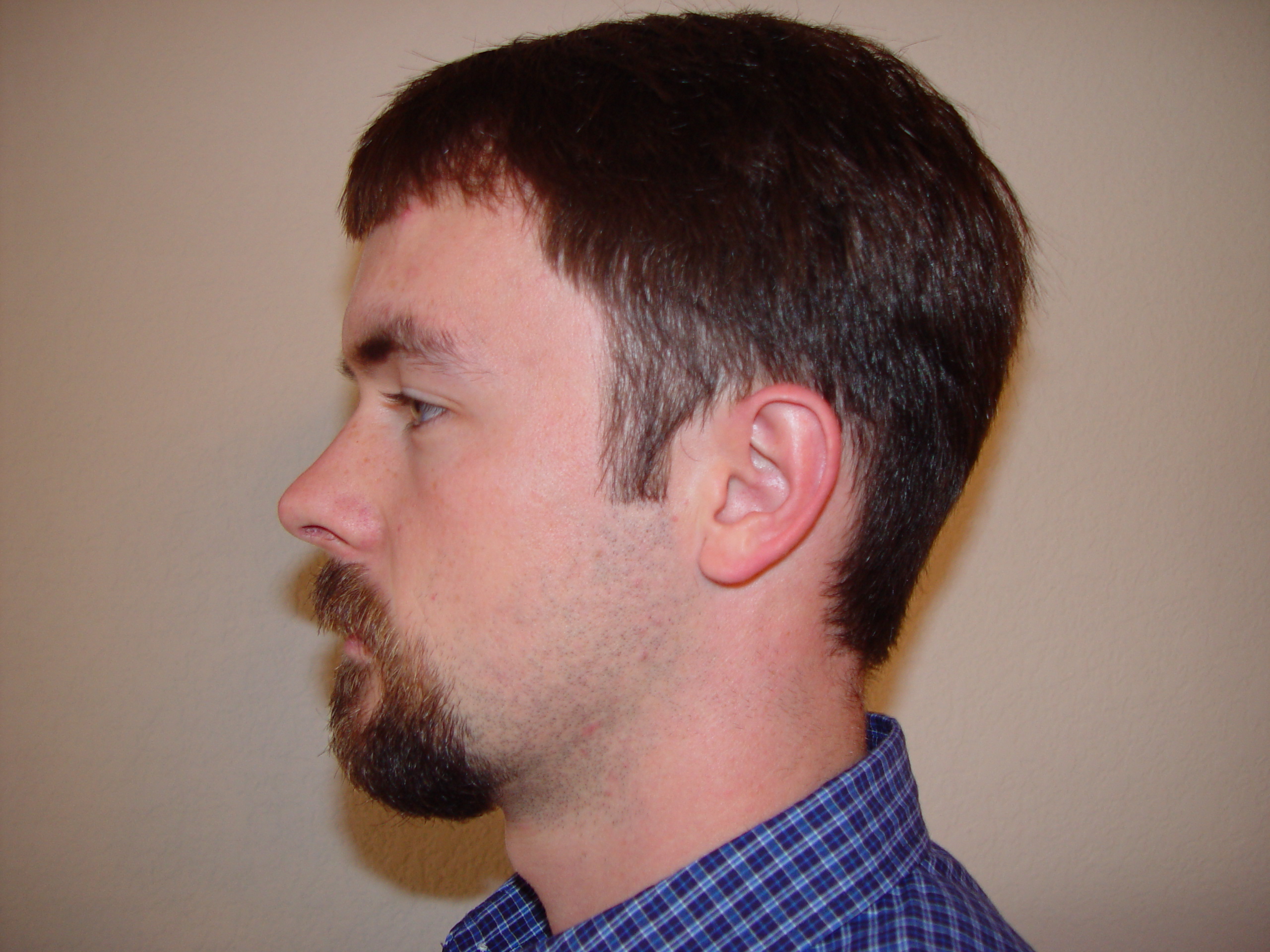 Return Of The Bearded Man