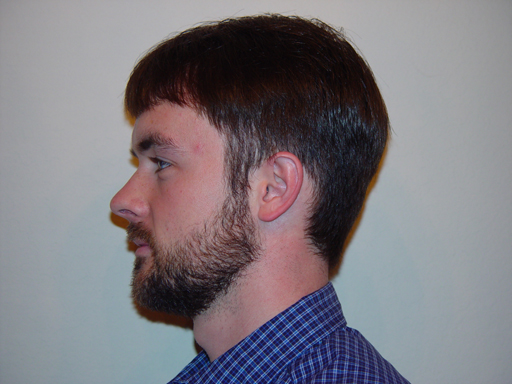 Return Of The Bearded Man