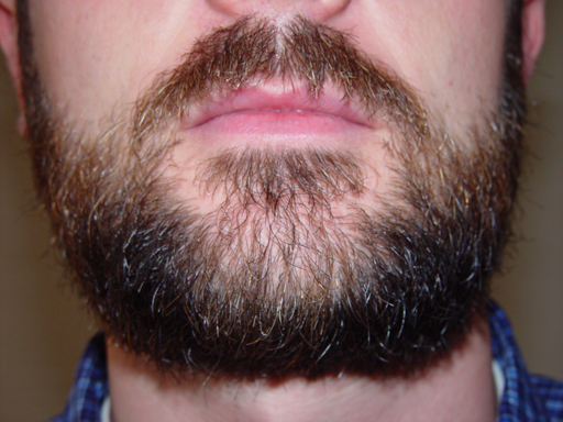 Return Of The Bearded Man