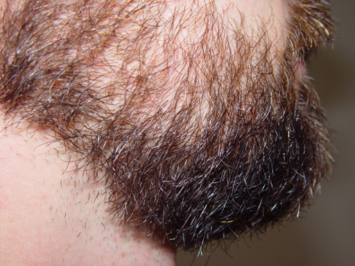 Return Of The Bearded Man