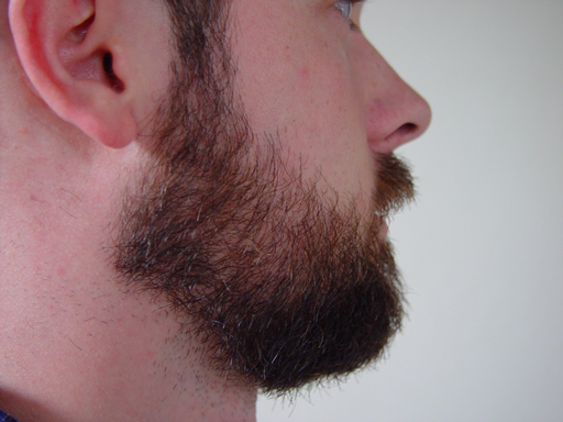 Return Of The Bearded Man