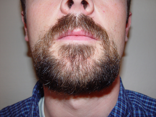 Return Of The Bearded Man