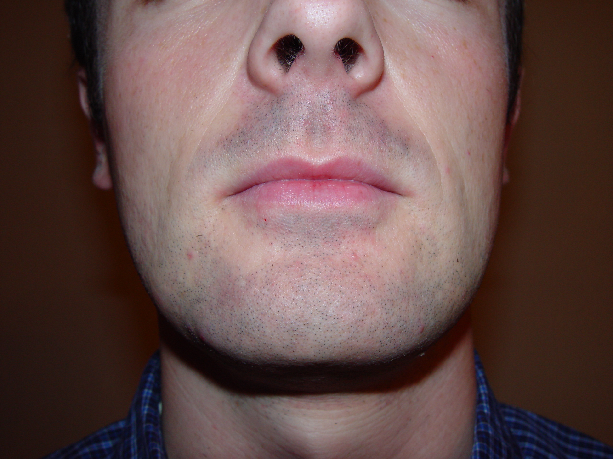Return Of The Bearded Man