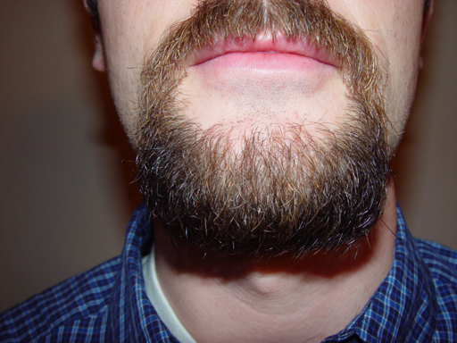 Return Of The Bearded Man