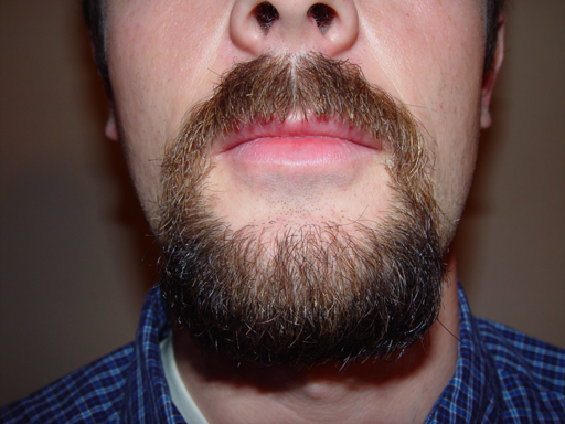 Return Of The Bearded Man