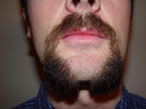 Return Of The Bearded Man