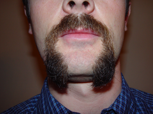 Return Of The Bearded Man