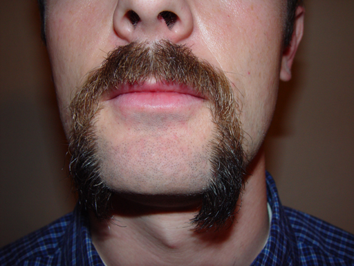 Return Of The Bearded Man