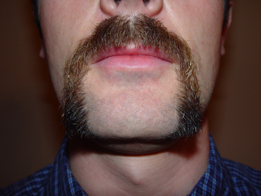 Return Of The Bearded Man