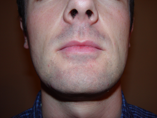 Return Of The Bearded Man
