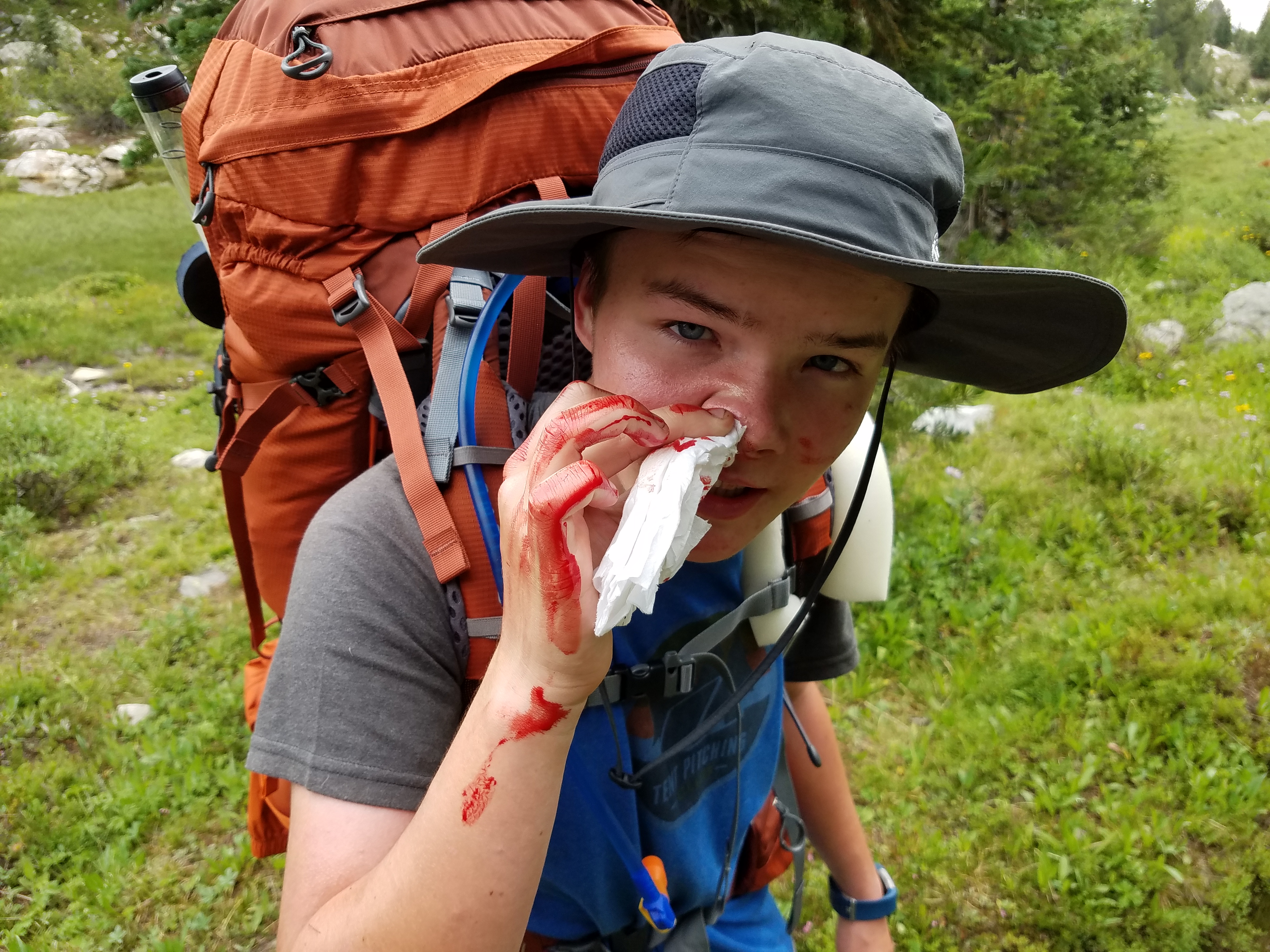 2017 Wind River Trip - Day 7 - Mount Victor Base Camp to Coyote Lake, Zack's Bloody Nose, Old Cabin (Wind River Range, Wyoming)