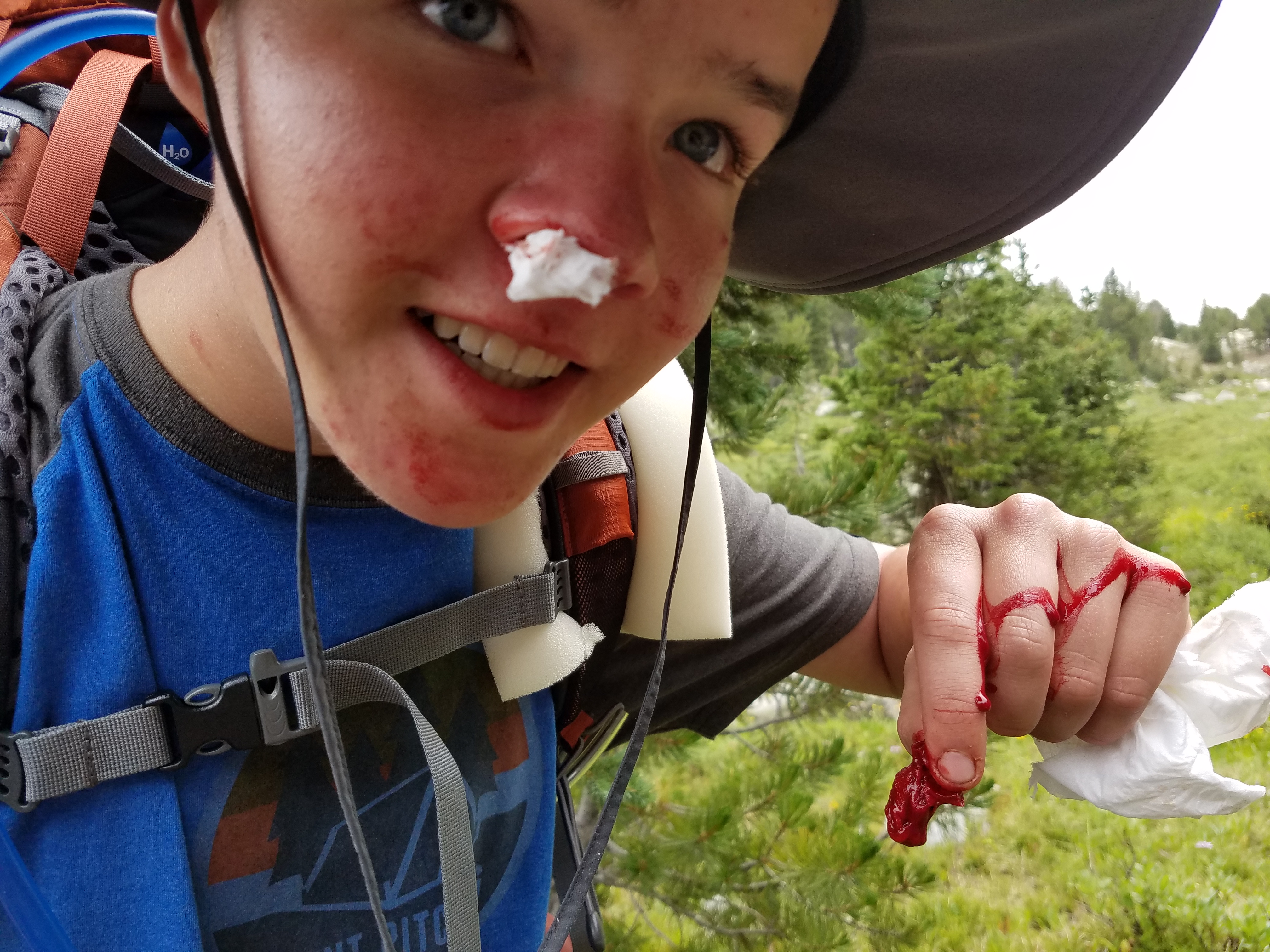 2017 Wind River Trip - Day 7 - Mount Victor Base Camp to Coyote Lake, Zack's Bloody Nose, Old Cabin (Wind River Range, Wyoming)